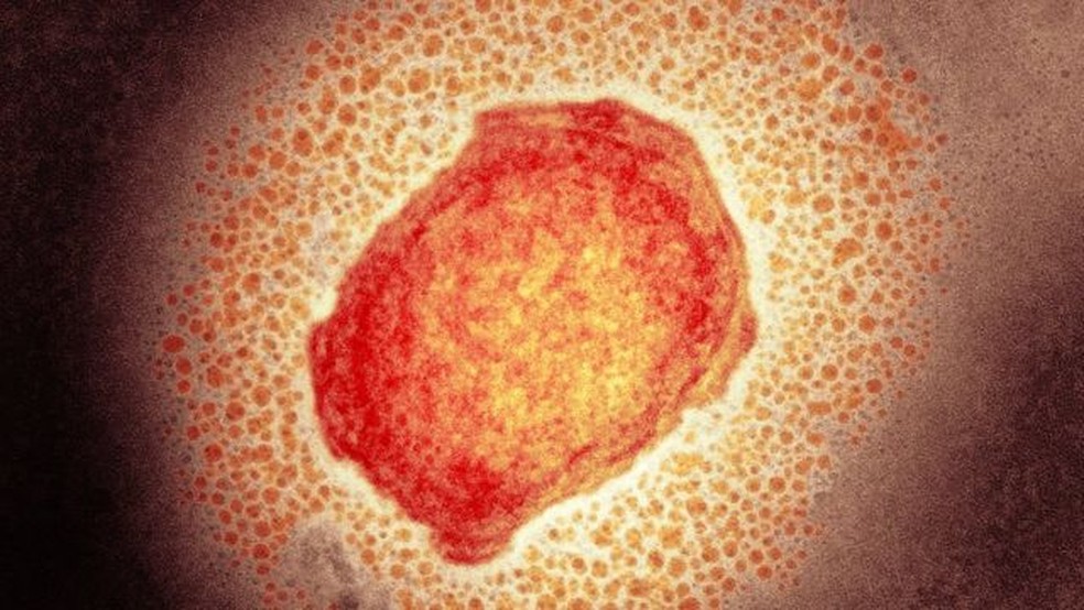 Partícula do vírus da varíola dos macacos — Foto: SCIENCE PHOTO LIBRARY/BBC