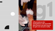 Influenciadores têm queimaduras e são socorridos após ficarem com pés imersos em gelo com sal para reality