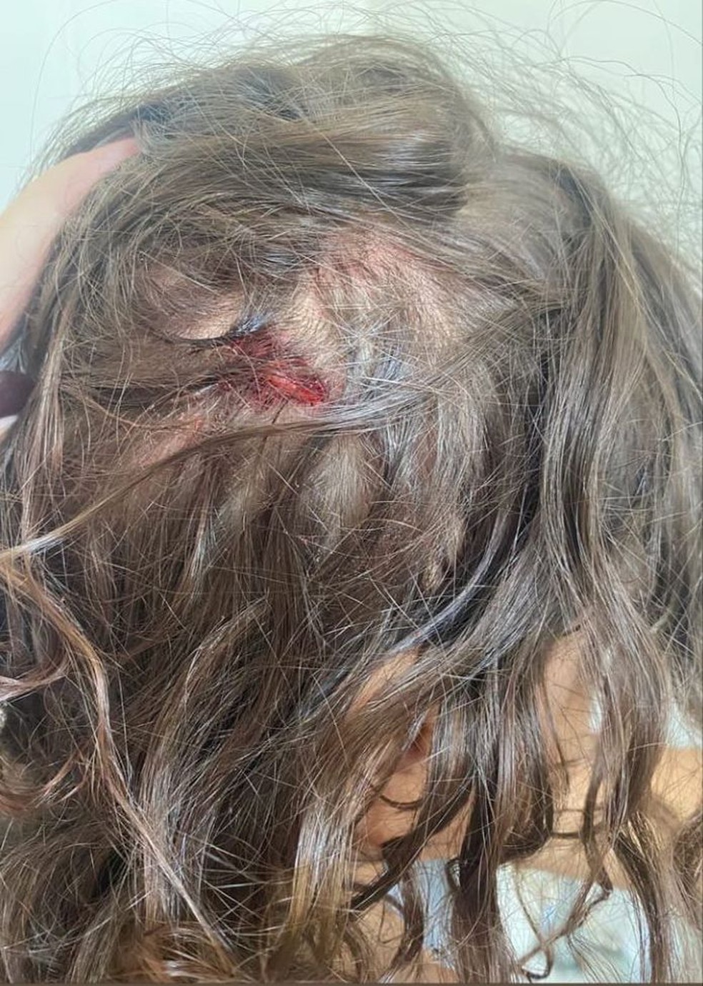 Criança teve corte profundo e precisou de pontos na cabeça — Foto: Arquivo pessoal 