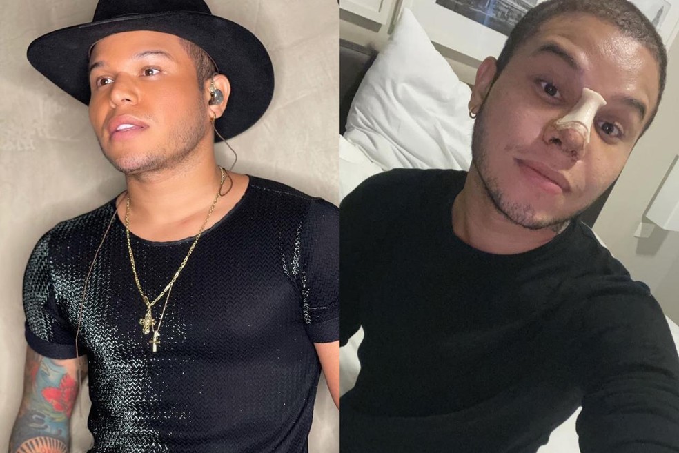 Tierry Faz Cirurgia No Nariz E Recebe Cuidados De Gabi Martins Um Cuida Do Outro Famosos Gshow