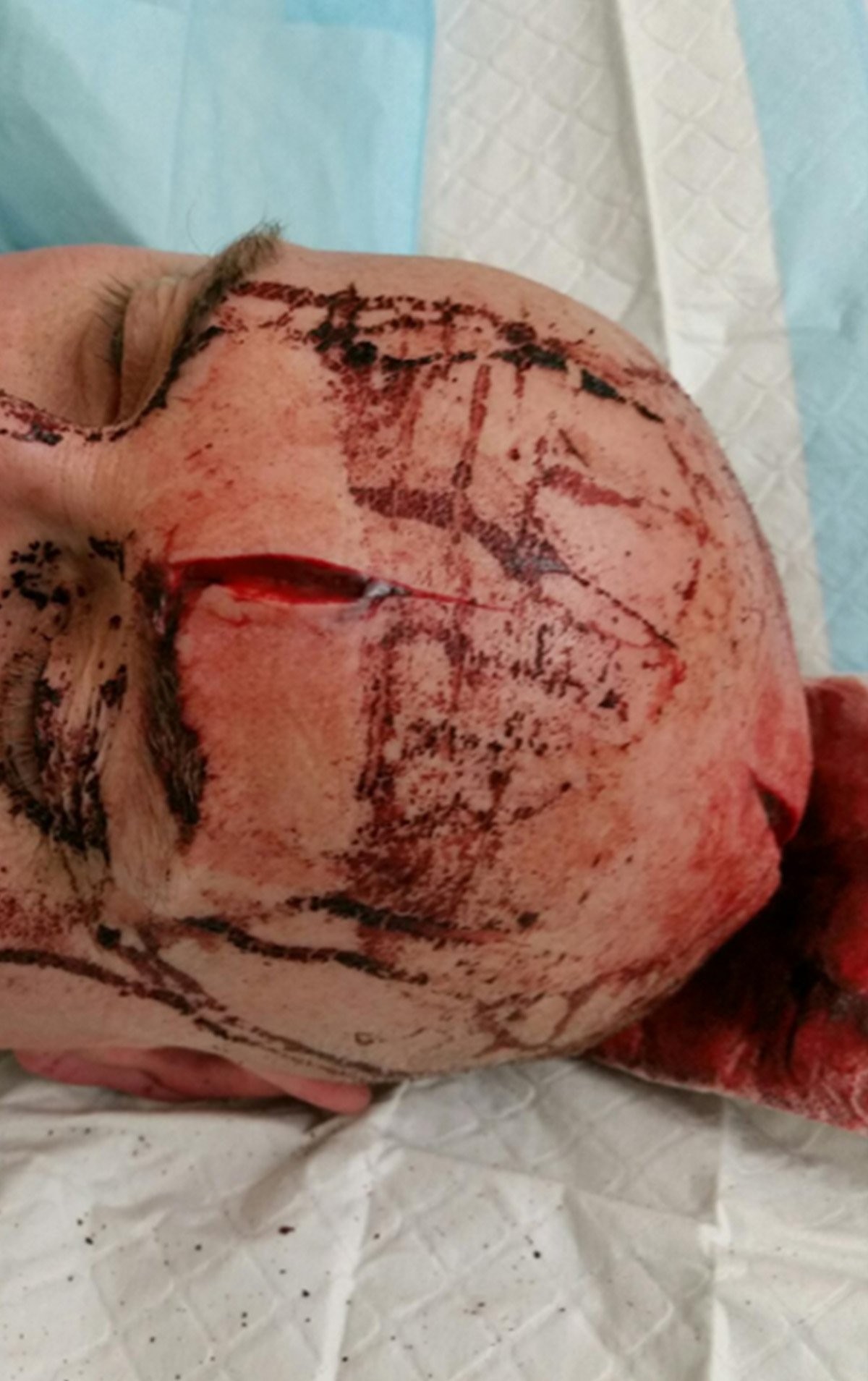 Policial ferido na cabeça com espada samurai