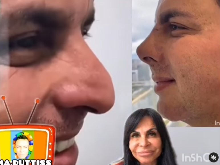 Esdras de Souza aposta em procedimento estético no nariz (Foto: reprodução/instagram)