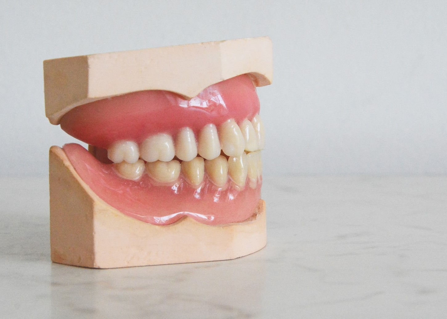 Segundo o IBGE, 34 milhões brasileiros adultos já perderam 13 ou mais dentes e 14 milhões vivem sem nenhum (Foto: Unsplash)