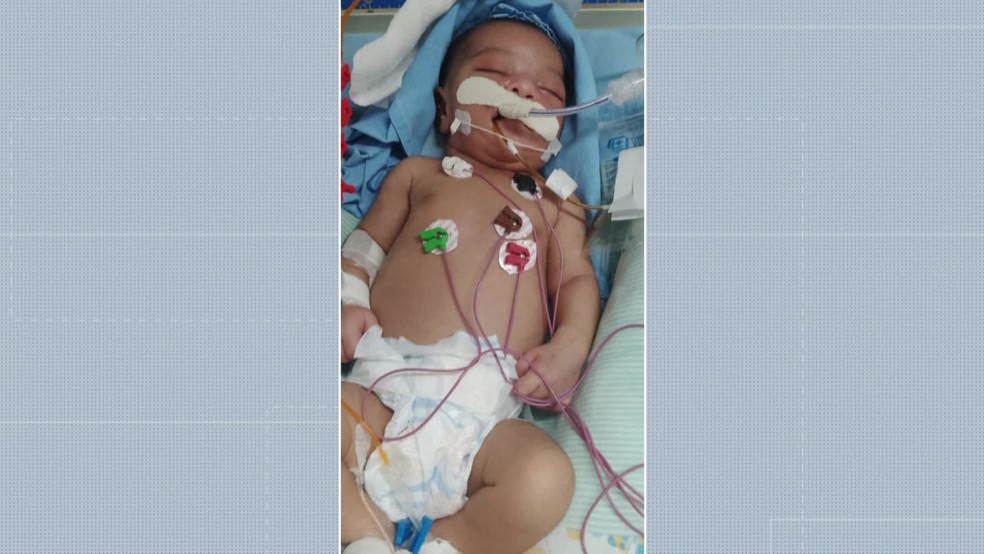 Bebê Eloá Vitória nasceu com doença rara no coração — Foto: Reprodução/WhatsApp