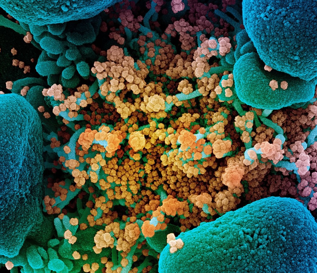 Micrografia eletrônica de uma célula (azul) fortemente infectada com partículas do vírus Sars-CoV-2 (amarelo), isolada de uma amostra de paciente (Foto: NIH Image Gallery)