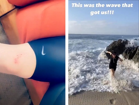 Rebel Wilson arranhou diferentes partes do corpo após bater em uma rocha no mar (Foto: Reprodução / Instagram)