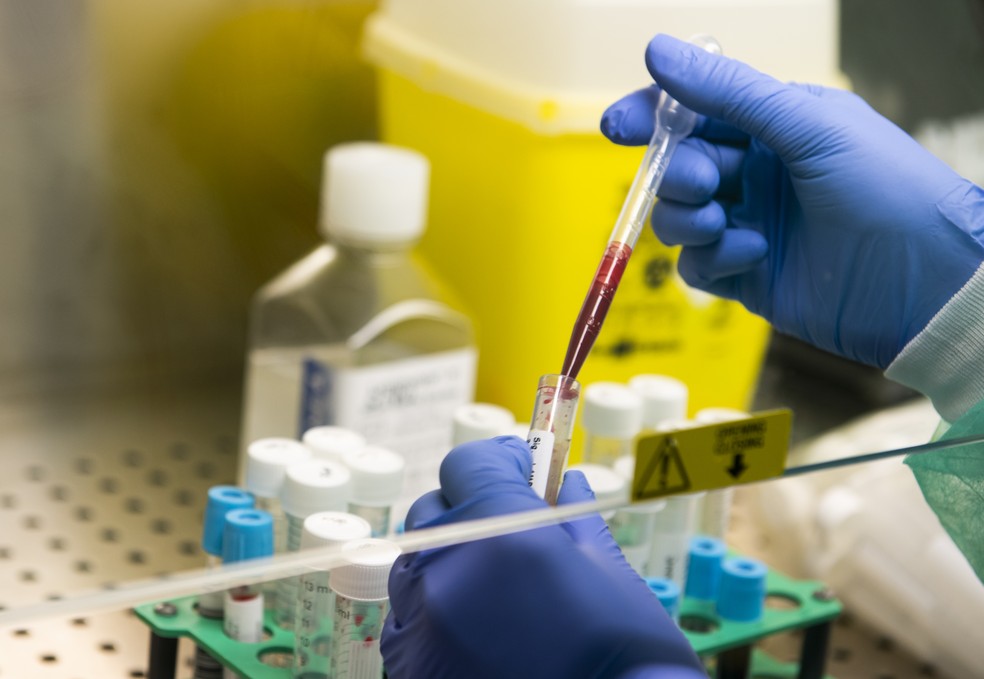 O Ceará já realizou mais de 300 mil testes para detecção da Covid-19 — Foto: AFP