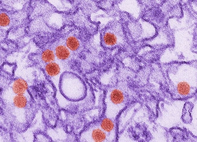 Composto inibe a ação de uma proteína que é ativada pelo vírus para suprimir a resposta imune do hospedeiro. Acima: micrografia eletrônica de transmissão colorida do vírus zika (Foto: Cynthia Goldsmith/CDC)