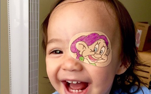 Pai criativo faz tapa-olhos personalizados para sua filha de 1 ano com catarata