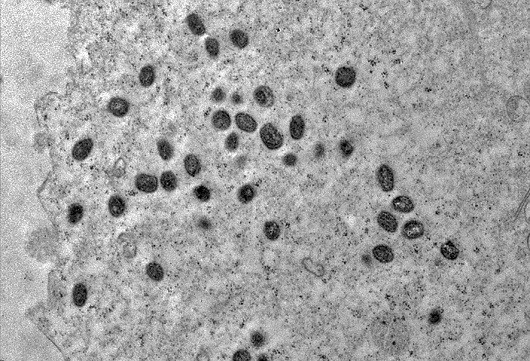 Partículas do vírus da varíola dos macacos se replicam no interior da célula  (Foto: Débora F. Barreto-Vieira, IOC/Fiocruz)