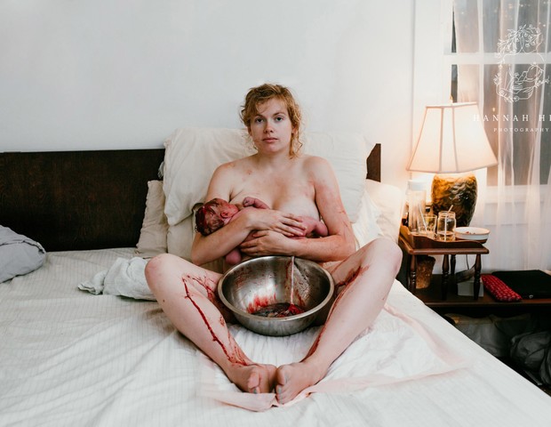 A fotógrafa norte-americana foi premiada na categoria melhor foto de pós-parto  (Foto: Hanna Colina)