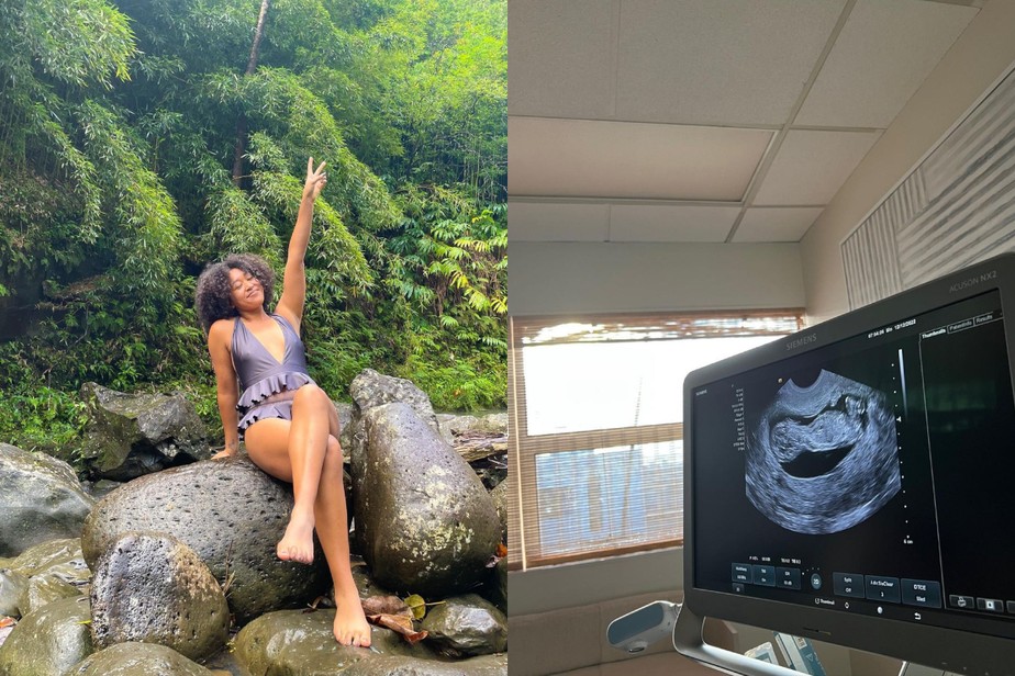 Tenista compartilhou foto de ultrassom no Instagram para anunciar gravidez