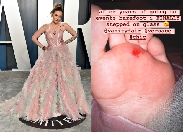 Resultado de imagem para paris jackson com pé machucado oscar 2020