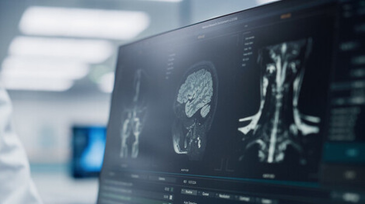 IA lê resultado de ressonância em 10 segundos | Tecnologia