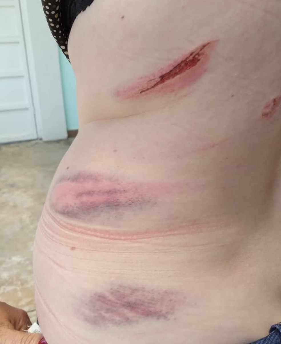 Comerciante de São Carlos é agredida por vizinhos com barra de ferro — Foto: Arquivo Pessoal