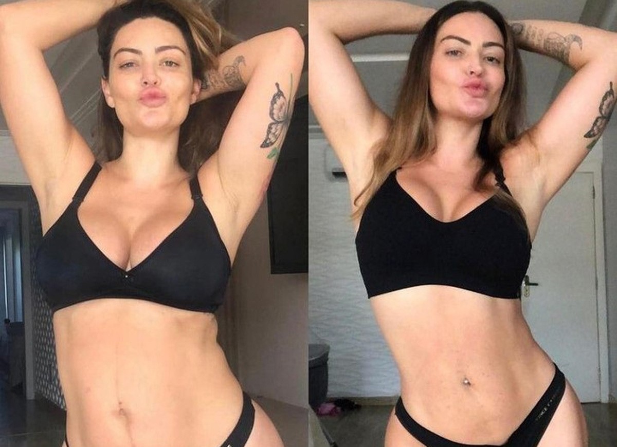 Laura Keller mostra antes e depois de emagrecer 17 quilos (Foto: Reprodução/Instagram)