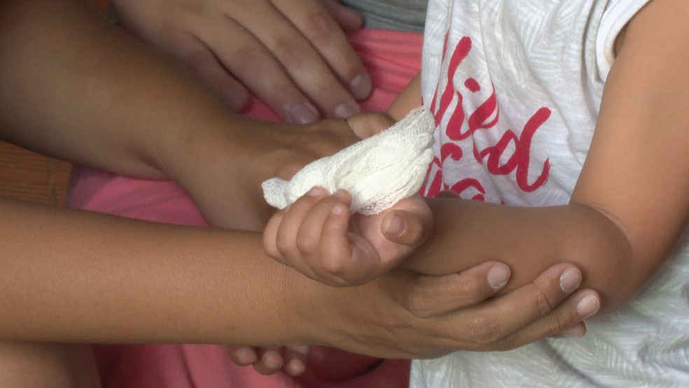 Crianca De 3 Anos Corta A Mao Com Prato De Vidro Em Creche No Df Distrito Federal G1