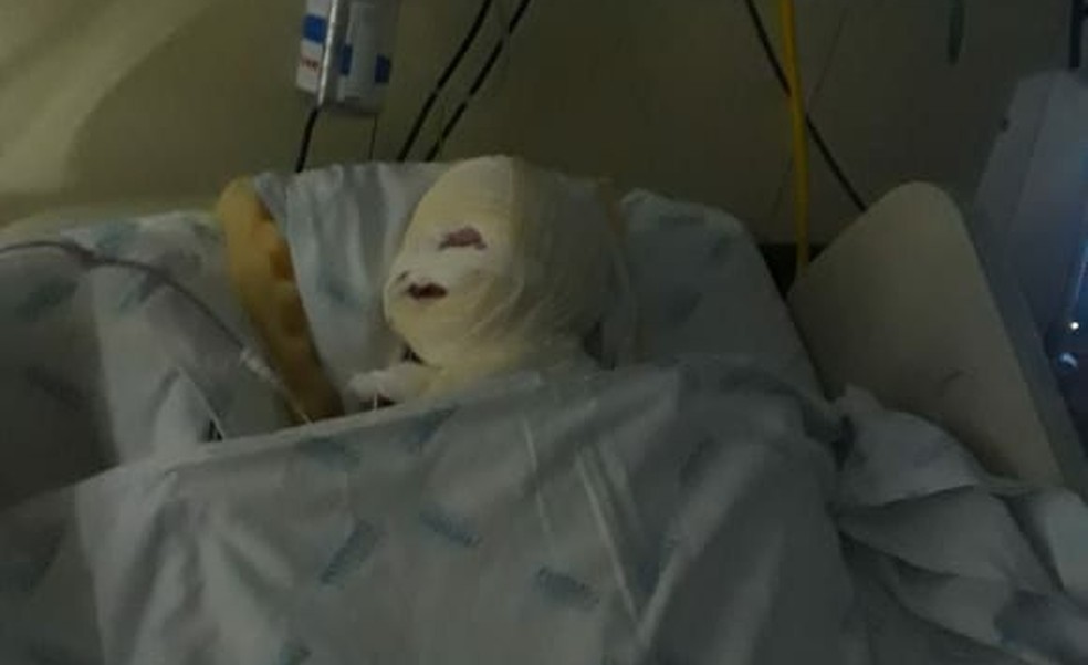 Bebe Ferido Apos Explosao De Aparelho Em Hospital De Bh Passa Por Terceira Cirurgia Minas Gerais G1