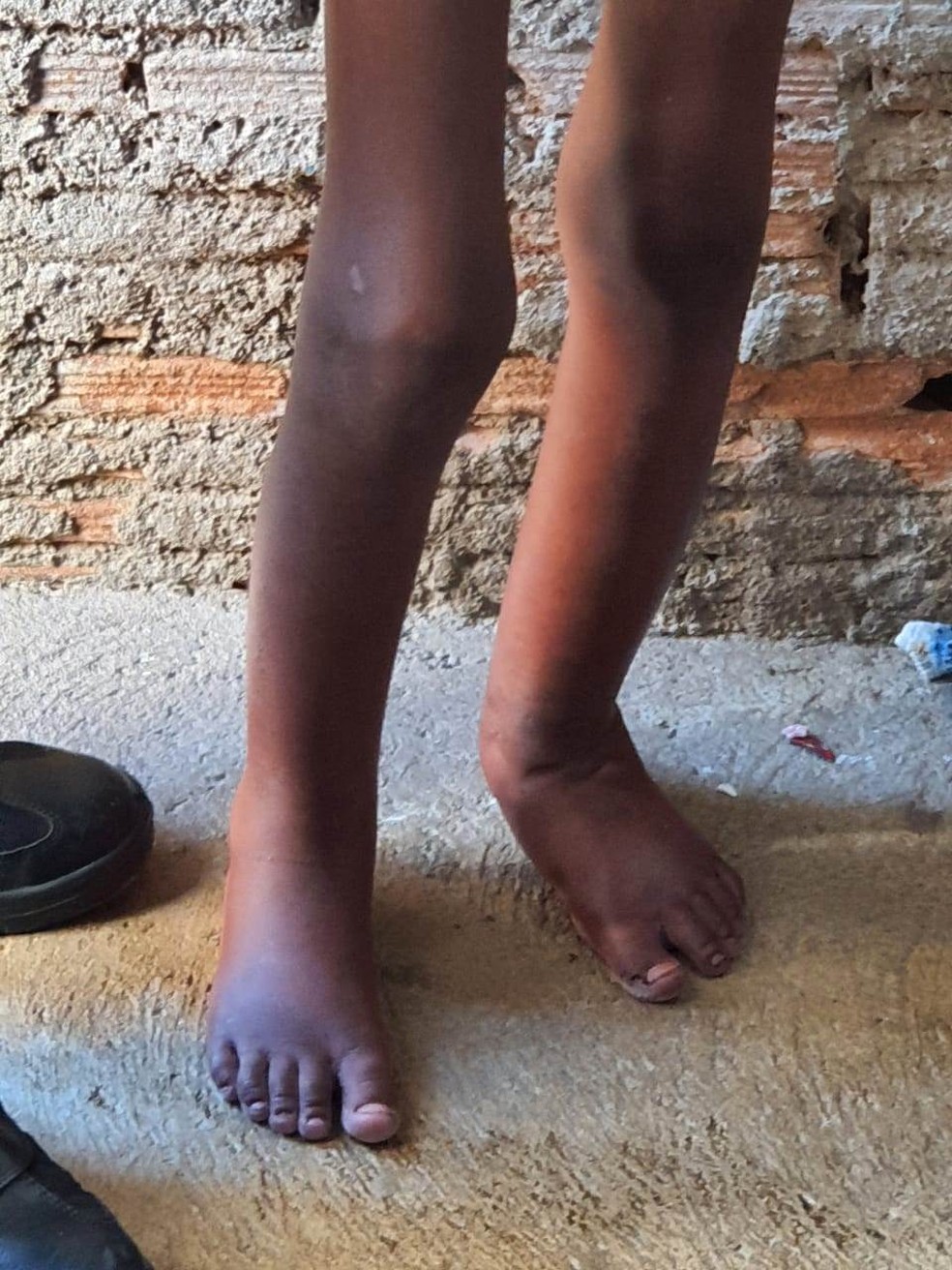 Criança foi resgatada após sofrer tortura em Campinas, diz PM — Foto: Polícia Militar
