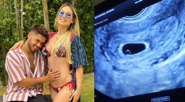 Virginia e Zé Felipe compartilham imagens do primeiro ultrassom do bebê (Foto: Reprodução Instagram/ You Tube)