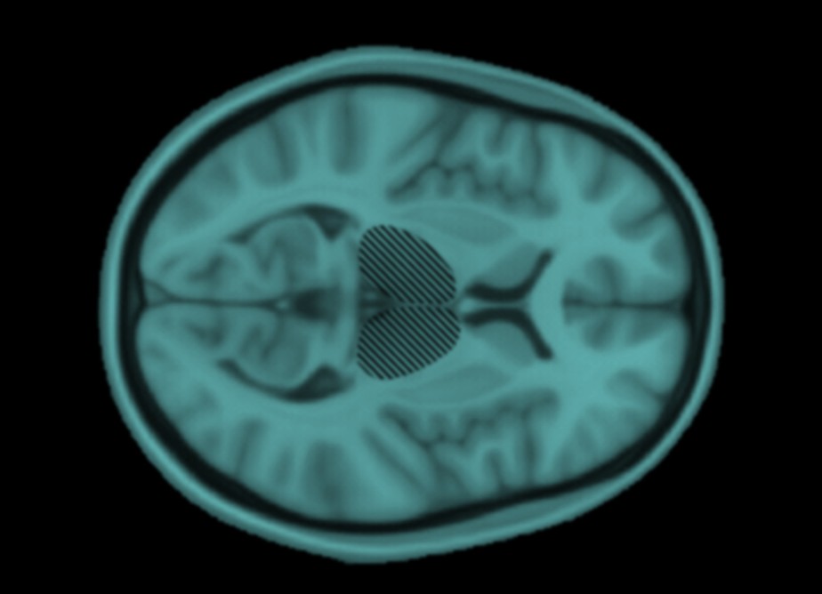 O tálamo (hachurado), estrutura do cérebro envolvida na integração de sentidos