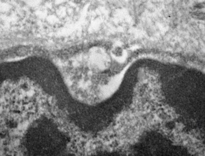 Estudo conduzido na Faculdade de Medicina da USP sugere que tecidos especializados na produção e secreção de saliva servem de reservatórios para o SARS-CoV-2, contribuindo para ampliar o potencial infeccioso do vírus (imagem de microscopia eletrônica mostra o novo coronavírus no interior das glândulas salivares) (Foto: Bruno Matuck/USP)