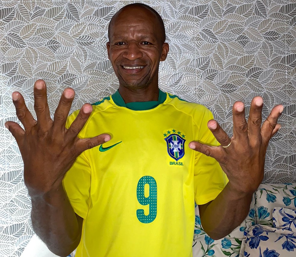 Baiano com seis dedos pretende comemorar hexa da seleção com uma mão só — Foto: Arquivo Pessoal