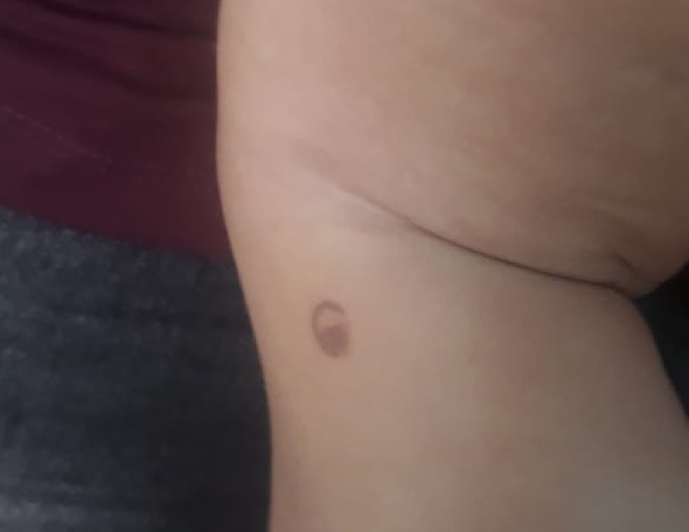 Mãe também é suspeita de queimar a bebê  — Foto: Divulgação