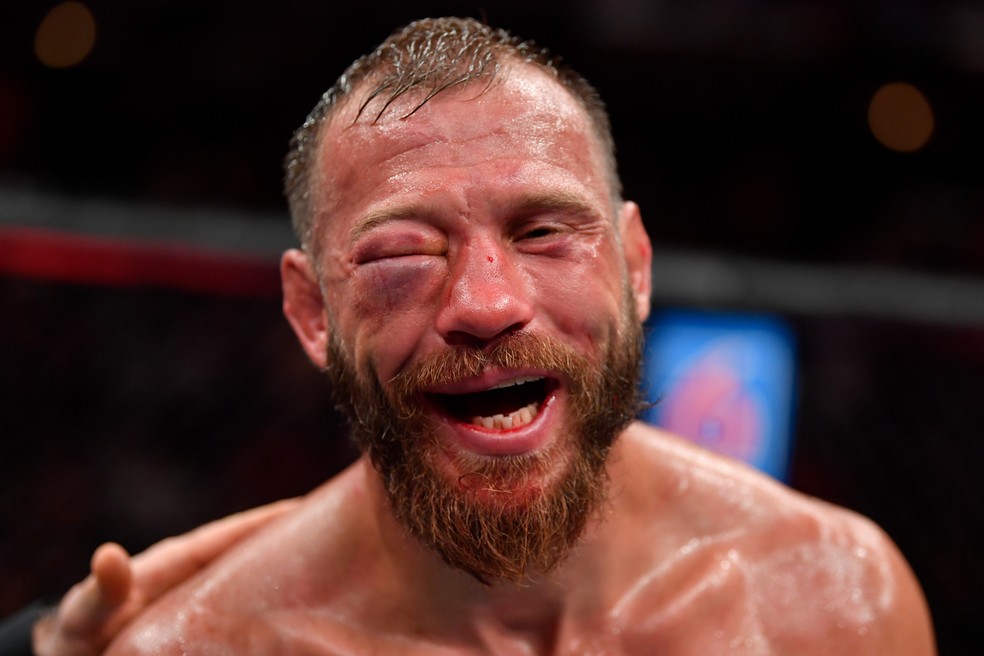 Cerrone Deixa Octogono Com Inchaco Gigante No Olho E E Levado Para Hospital Veja Fotos Combate Sportv