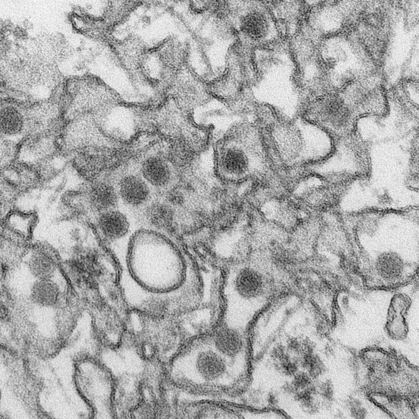 Vírus da zika  (Foto: Wikipedia Commons)