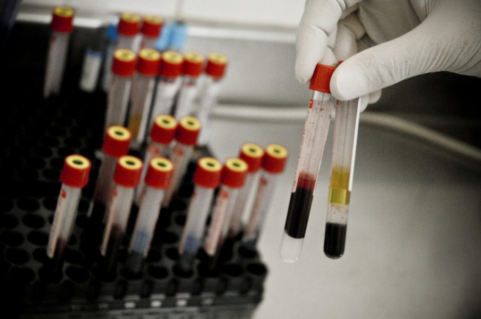 Testes que detectam anticorpos IgM no sangue. — Foto: Breno Esaki/Agência Saúde
