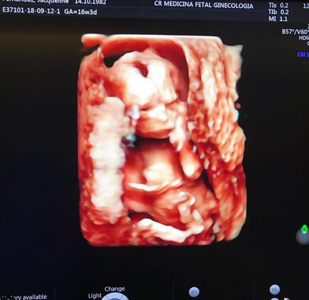 Marcio Kieling anuncia chegada de primeiro filho (Foto: Reprodução/Instagram)