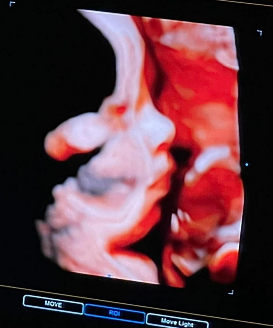 Bárbara Evans mostra ultrassom de filha (Foto: Instagram)