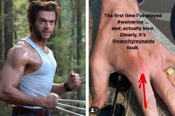 Hugh Jackman como Wolverine (esq.) e imagem do machucado que ele fez em X-Men Origens: Wolverine (2009) (Foto: Divulgação; Reprodução / Instagram)