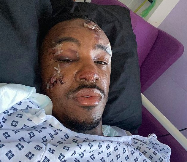 O rapper Bugzy Malone no leito hospitalar no qual se recupera de seu acidente de moto (Foto: Twitter)