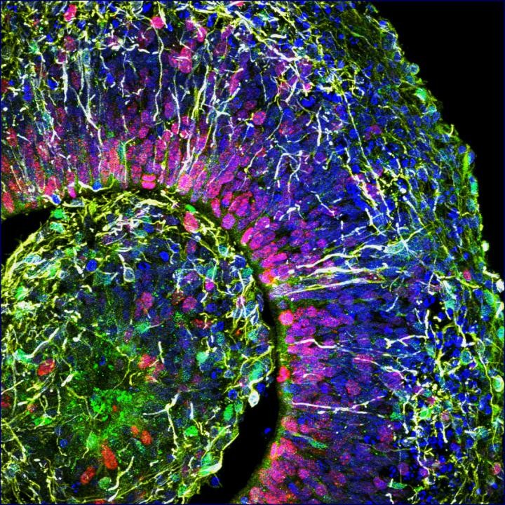 Parte de um organoide cerebral (Foto: Muotri Lab/UCTV)