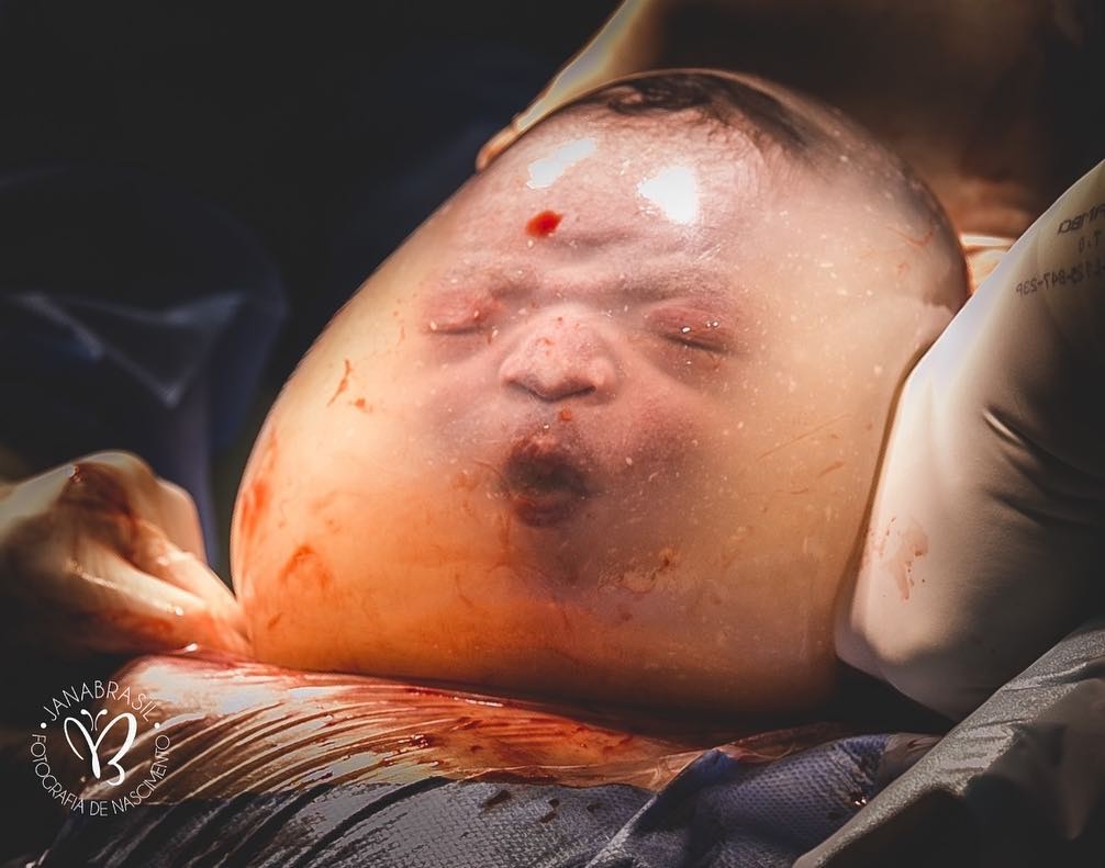 As fotos do bebê empelicado impressionaram a web (Foto: Reprodução/ Instagram Jana Brasil)