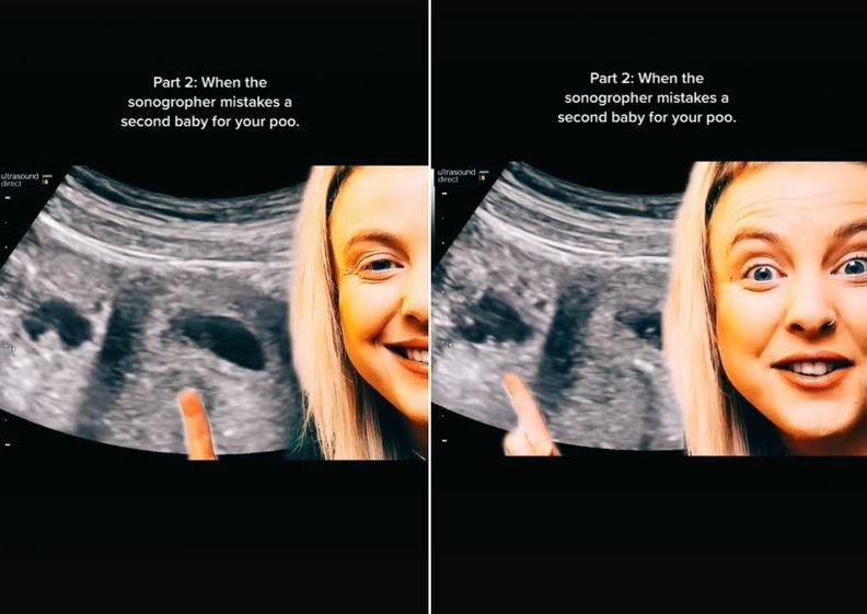 Mãe conta sobre confusão em exame de ultrassom  (Foto: Reprodução Tik Tok )