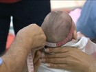 Secretaria de Saúde de PE confirma 27 casos de microcefalia no Sertão