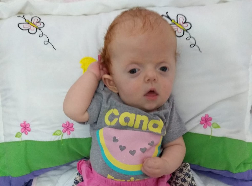 Familia Faz Campanha Na Web Para Pagar Cirurgia De Bebe Com