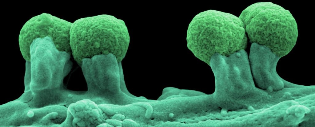  (Foto: E. coli attached to intestines. Credit: ZEISS Microscopy)