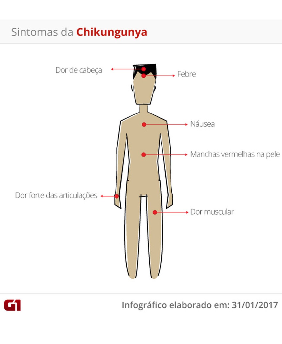 chikungunya sintomas (Foto: Arte/G1)