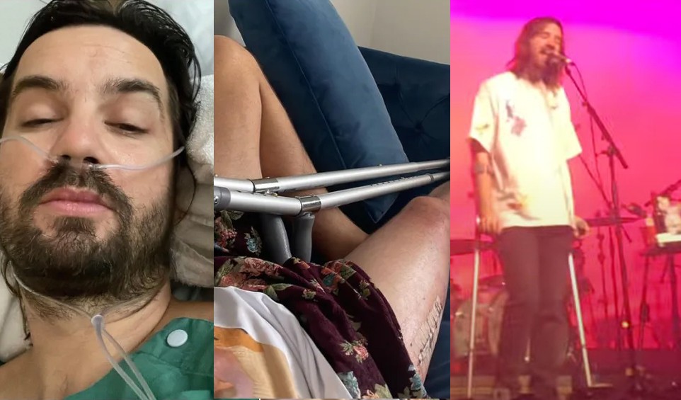 Kevin Parker, do Tame Impala, explica decisão de vir ao Lolla mesmo de muletas e quadril fraturado