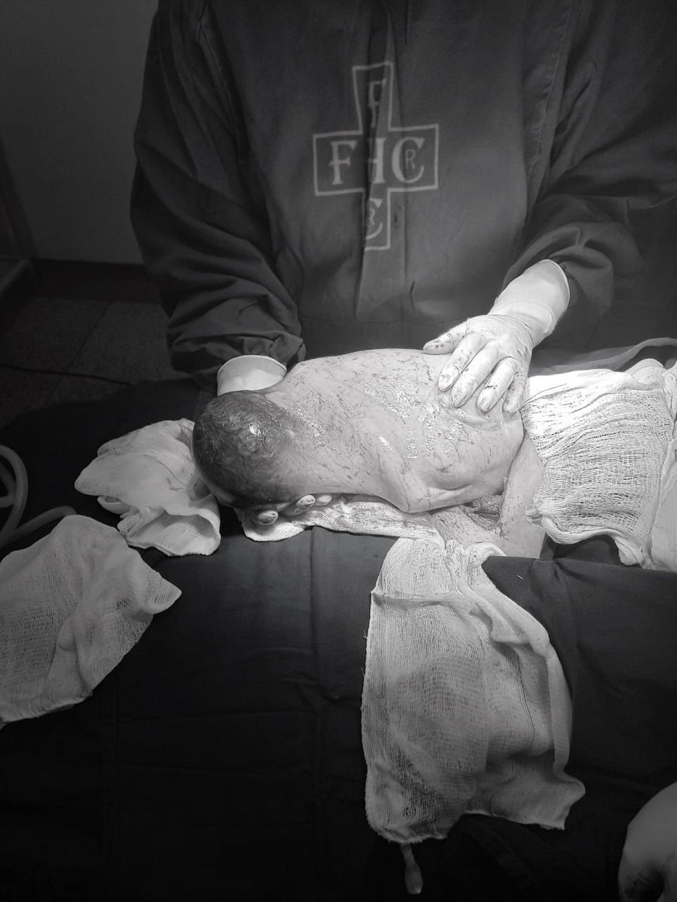 O parto empelicado não traz malefícios nem para a mãe e nem para o bebê — Foto: MS Todo Dia/Reprodução