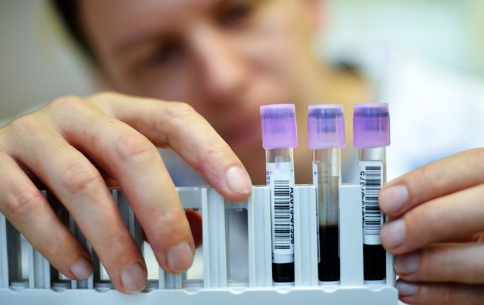 exame antidoping copa do mundo laboratorio suíça (Foto: EFE)