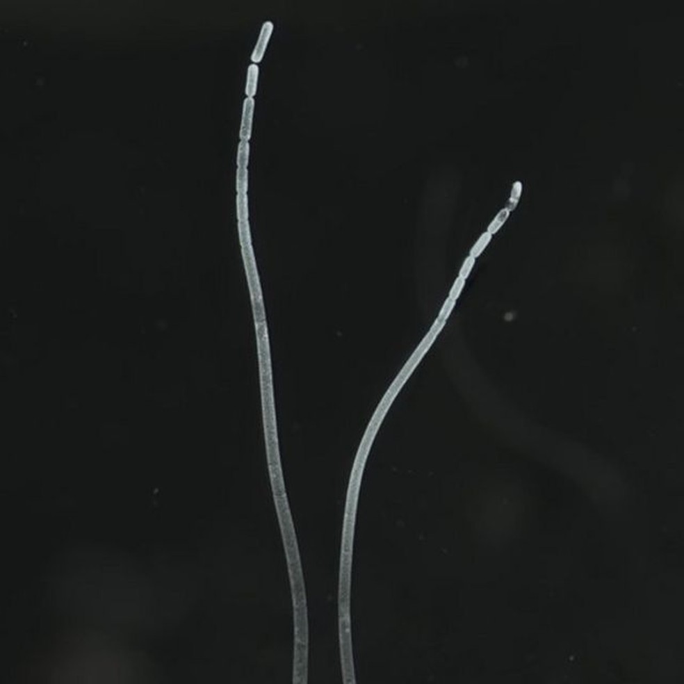 T. magnifica chega até a 2 centímetros de comprimento — Foto: LAWRENCE BERKELEY NATIONAL LABORATORY/BBC