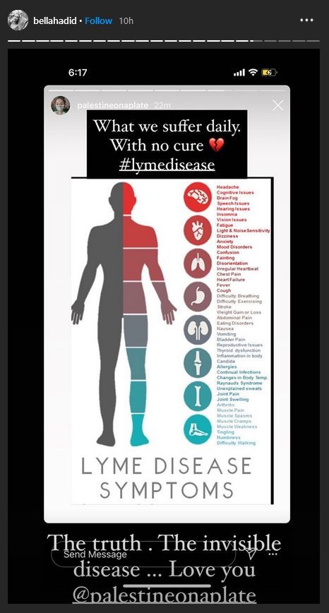 Bella Hadid sobre a doença de Lyme (Foto: Instagram)