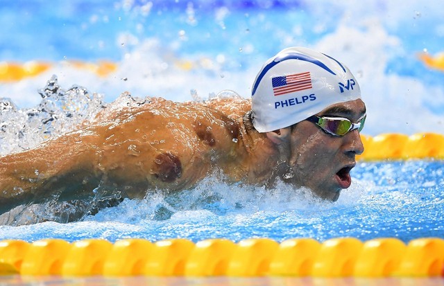 Michael Phelps é um dos muitos atletas de elite que recorrem à ventosaterapia (Foto: Getty Images)