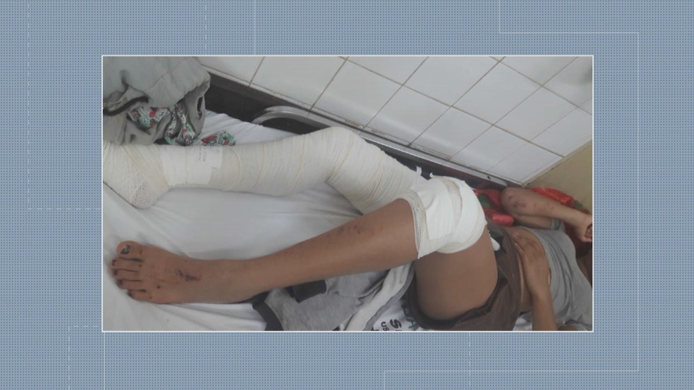 Adolescente de 14 anos sofreu fraturas na bacia e aguarda cirurgia — Foto: TV Globo/Reprodução