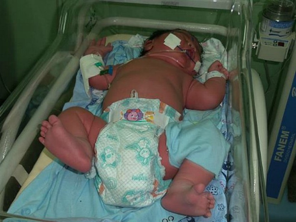 Bebê nasceu com quase 7 kg em Parintins — Foto: Arquivo Pessoal